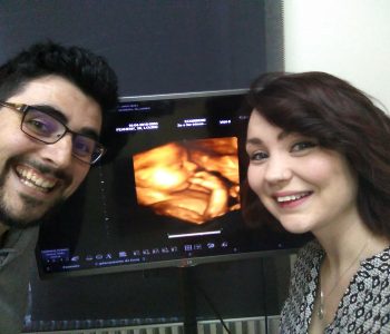 4D Scan in Madrid